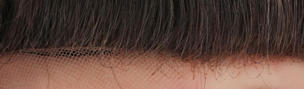 Lace Hair System