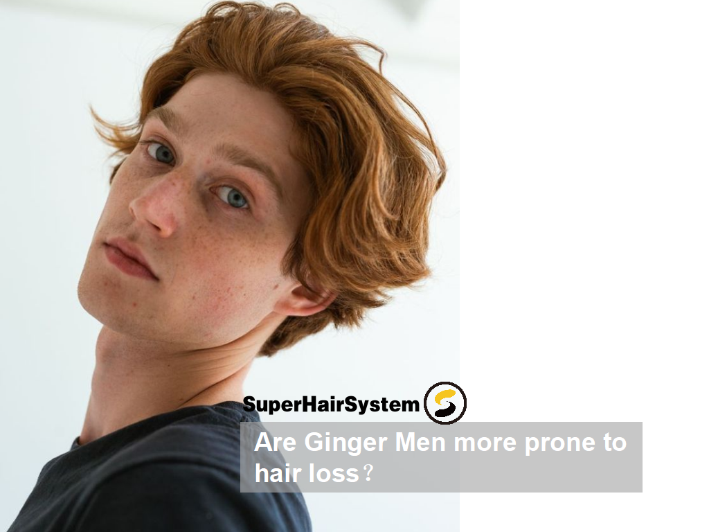 Are Ginger Men more prone to hair loss？