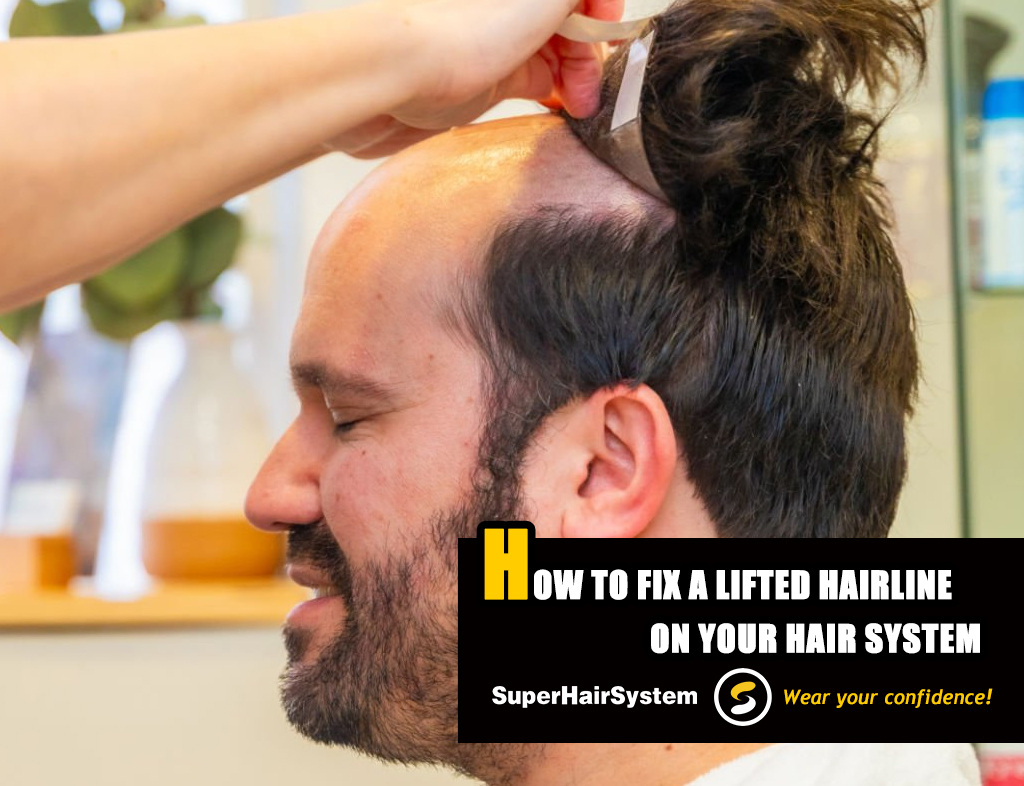 How to Fix a Lifted Hairline on Your Hair System