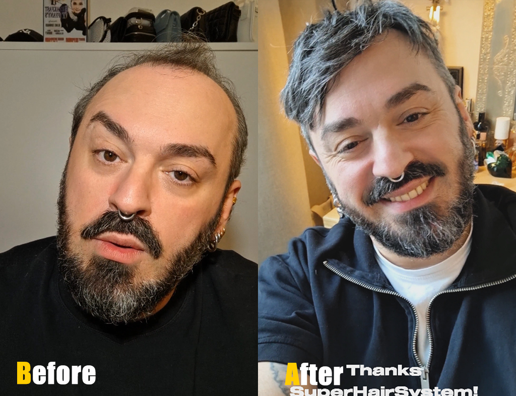 Before and after wearing the toupee