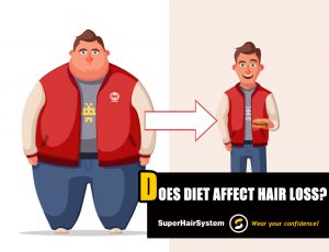 Does Diet Affect Hair Loss