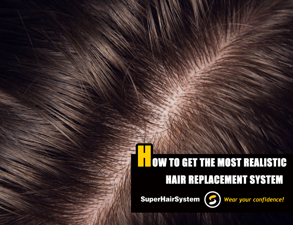 How to Get the Most Realistic Hair Replacement Systems