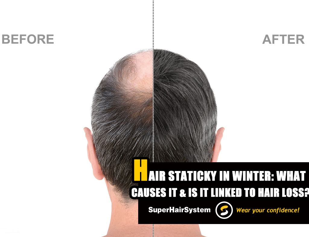 Hair Staticky in Winter What Causes It and Is It Linked to Hair Loss